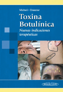 MICHELI:TOXINA BOTUL?NICA