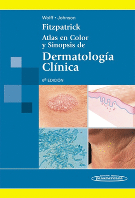 FITZPATRICK: ATLAS EN COLOR Y SINOPSIS DE DERMATOLOGA CLNICA