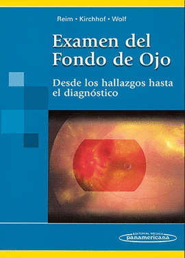 EXAMEN DEL FONDO DE OJO