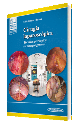 CIRUGIA LAPAROSCOPICA