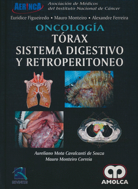 ONCOLOGIA