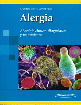 ALERGIA