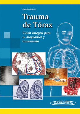 TRAUMA DE T�RAX