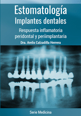 ESTOMATOLOGA. IMPLANTES DENTALES